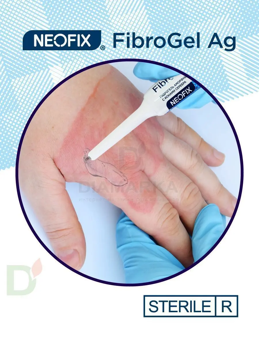 Гидрогель антимикробный NEOFIX FibroGel Fg с ионами серебра 15г в Ростове-на-Дону